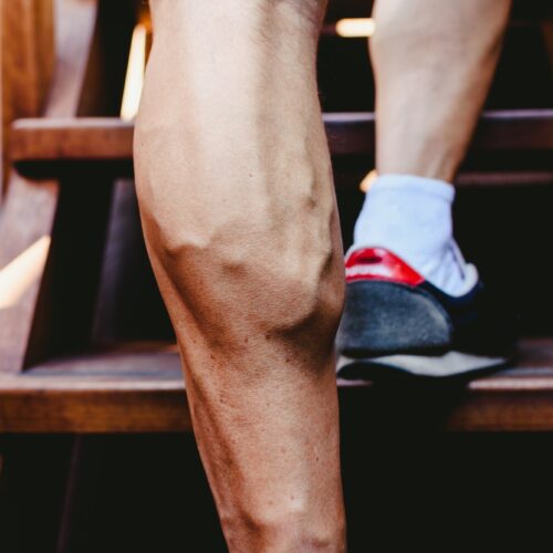 Large visible veins of calf muscles in a man's leg.